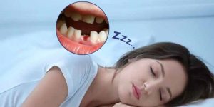 Liên hệ con số may mắn cùng việc nằm mơ rụng răng Liên hệ con số may mắn cùng việc nằm mơ rụng răng