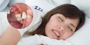 9WIN lý giải hiện tượng mơ rụng răng 9WIN lý giải hiện tượng mơ rụng răng